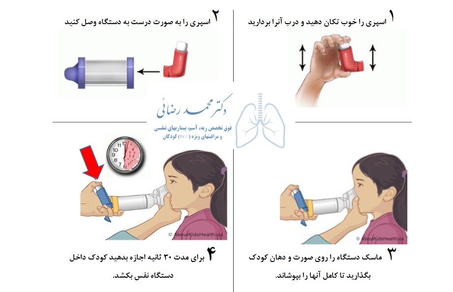 نحوه استفاده از اسپری در کودکان زیر 5 سال